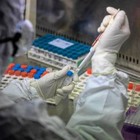 Coronavirus, farmaco anti-artrite Tocilizumab: Aifa lavora per avviare sperimentazione