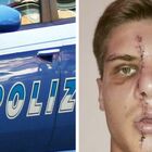 Milano, ragazzo ucraino di 19 anni sfregiato al volto e rapinato a Porta Garibaldi: arrestati 11 egiziani
