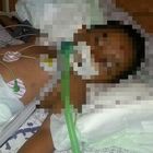 Morto il bambino picchiato dal padre col tubo dell'aspirapolvere perché non fa i compiti