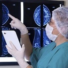 Tumore al seno curato senza chemio, a Monza lo studio sperimentale: «Grande soddisfazione delle pazienti»