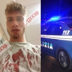ESCLUSIVO/ Roma, denuncia choc di Marco: «Fermato e picchiato a sangue da un poliziotto in borghese»