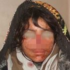 Afghanistan, tortura la moglie per mesi prima di tagliarle il naso: poi scappa e sposa una bimba di 7 anni