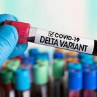 Covid: altri 16 casi legati a variante Delta in Abruzzo