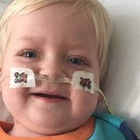 Inghilterra, bimbo di due anni in coma per un tumore si sveglia mentre i genitori stanno staccando la spina