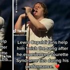 Lewis Capaldi, la sindrome di Tourette: non riesce a cantare, i fan lo fanno per lui. Il video su TikTok è commovente