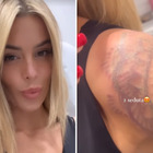 Sophie Codegoni e la rimozione del tatuaggio: «Fa troppo male. Prima di farne un altro ci penserò mille volte»