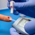 immagine Diabete, paziente guarito in Cina grazie a trapianto cellule di staminali: è il primo al mondo, non assume più farmaci da due anni