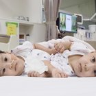 Gemelline siamesi separate: Nina e Dawa condividevano torso e fegato, intervento di 6 ore
