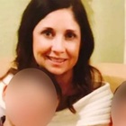 Muore a 36 anni durante l'intervento estetico al seno: medico accusato di omicidio