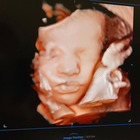Chiara Ferragni e Fedez, la nuova ecografia della bimba in arrivo. I fan notano un dettaglio: «Guarda le labbra...»