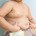 Bambini sovrappeso, dall'aumento di peso alla dieta, l'allarme dei pediatri: «Il picco nel Lazio, ecco come aiutarli a dimagrire»