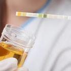Tumori, un test delle urine permetterà di individuarlo: tecnologia britannica rivoluzionaria