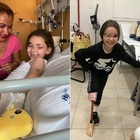 Angela, 7 anni e la gamba amputata dopo l'incidente alla comunione. La mamma: «Le foto di Bebe Vio per darle coraggio»