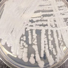 Candida auris, il fungo resistente agli antibiotici che preoccupa i medici: «Può uccidere in 3 mesi»