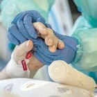 Covid, alleanza tra medici per «gli altri malati»: nuova task force di oncologi, cardiologi ed ematologi