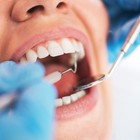 Dentista la opera e le estrae dieci denti per un'infezione: donna muore dissanguata