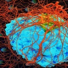 Tumori, lo studio sul virus dell'herpes