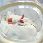 Padova, scuote il figlio di 5 mesi perché non dorme: i medici valutano la morte cerebrale