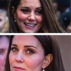 Kate Middleton, quel dettaglio sulla fronte: ecco cosa hanno notato sulla tempia
