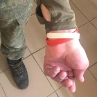 Guerra in Ucraina, la Russia arruola i malati di epatite e Hiv: «Hanno braccialetti di riconoscimento»