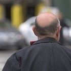 «Farmaco contro la caduta dei capelli mi ha reso impotente»: la denuncia di un 35enne a Milano