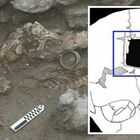 Operazione al cranio risalente all'età del bronzo