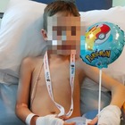 Bimbo di 8 anni sente dolore durante lo shampoo: i medici pensano a un'infezione ma è un tumore rarissimo