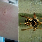 Punta da una vespa, donna muore per choc anafilattico