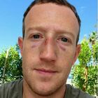 Musk contro Zuckerberg, il combattimento c'è stato? Il papà di Facebook si mostra con ferite e lividi: «Lo scontro è andato un po' oltre...»