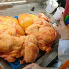 Tumore, operazione record all'ospedale di Pagani: asportata massa da 10 chili nell'addome di una ragazza di 28 anni