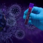 Nuova variante Kraken negli Usa, epidemiologo Feigl-Ding: «Evade la protezione immunitaria e raddoppia i casi in una settimana»