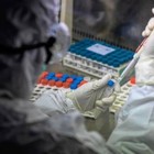 Aifa: giovedì via ai test farmaco anti-artrite su 330 pazienti