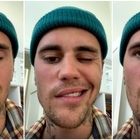 Justin Bieber e la sindrome di Ramsay Hunt: «Ho metà del viso paralizzato». Concerti annullati