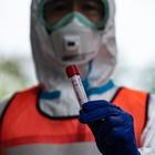Coronavirus, la Germania studia la soluzione: vaccino anti-Tbc attivo anche contro il Covid?