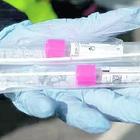 Coronavirus, stop ai test "facili": tampone solo a chi ha i sintomi