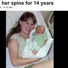 Mamma 41enne aveva un ago nella schiena: "Dimenticato per 14 anni dopo l'epidurale"