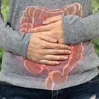 Tumore del colon-retto, aumentano i casi giovanili