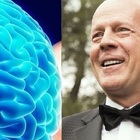 Afasia,malattia che ha colpito Bruce Willis