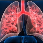 Tumori, l'allarme degli oncologi sull'amianto