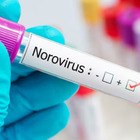 Norovirus, sale l'allarme in Italia: sintomi (diarrea, vomito e crampi addominali), trasmissione e cura per il virus intestinale. La guida