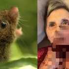 Disabile e allettata in un lago di sangue: «Un topo le ha mangiato la faccia fino all'osso»
