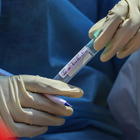Coronavirus, Diasorin: «Test anticorpi pronti entro fine aprile»