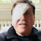 Gianni Morandi, foto con l'occhio bendato: «Ho fatto a pugni». Da Emma a Cesare Cremonini, i messaggi d'affetto