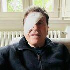 Gianni Morandi, foto con l'occhio bendato: il motivo