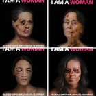 Da Merkel a Clinton, le donne potenti con i lividi sul viso: i poster choc diventano virali