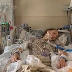 immagine Si ammala ai polmoni fumando la sigaretta, studentessa 18enne in coma