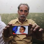 Pakistan, cristiana arsa viva è morta: Asma Yaqub si era rifiutata di convertirsi all'Islam