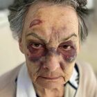 Anziana di 83 anni presa a bastonate da un senzatetto in pieno centro: si era rifiutata di dargli l'elemosina