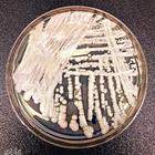 Candida Auris, il fungo mutato con il riscaldamento globale: può uccidere in 90 giorni