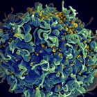 Aids, la terapia innovativa contro l'Hiv